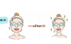 面部整形有哪項(xiàng)目？