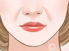 脂肪填充法令紋的價(jià)格是多少？