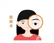 微創(chuàng)提眉術(shù)手術(shù)方法？微創(chuàng)提眉術(shù)的特點(diǎn)？