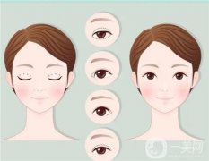 做切開雙眼皮手術(shù)后可以護(hù)膚嗎？
