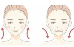 熱拉提多久做一次？熱拉提有哪些注意事項(xiàng)