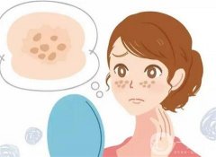 激光祛斑大概要多少錢?激光祛斑肌膚護(hù)理的方式有哪些?