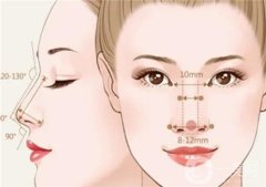 酒糟鼻整形術(shù)有沒有用?那種情況下可以做酒槽鼻整形