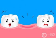 什么是種植義齒修復(fù)?有什么特點(diǎn)?