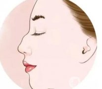 駝峰鼻矯正多久能恢復？需要注意什么？