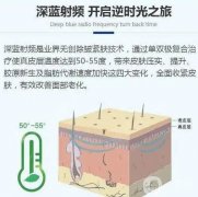 深藍(lán)射頻果能持續(xù)多久？副作用是什么？