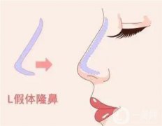 隆鼻假體取出是不是會很痛？恢復(fù)過程是怎么樣的？