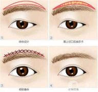什么情況需要切眉？會留疤嗎？