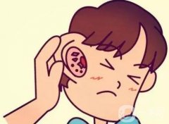 生物支架再造耳有哪些優(yōu)勢