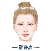 顴骨墊高消腫需要多長時間？顴骨墊高疼嗎