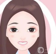 牙瓷貼片的種類有哪些？能堅持多久？