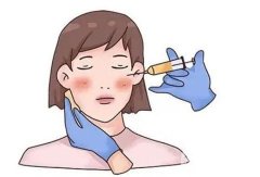 玻尿酸面部填充的優(yōu)勢(shì)？不適合哪些人？