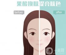 果酸換膚的果可以維持多久？有哪些癥狀適用于果酸換膚？