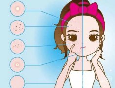 的作用是什么？結(jié)痂的注意事項(xiàng)有哪些？