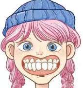 地包天是怎么形成的?地包天怎么矯正?