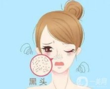 果酸換膚去黑頭的果怎么樣呢？有哪些醫(yī)美項目可以改良黑頭？