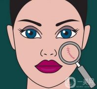 調節(jié)手術疤痕有什么好方法？