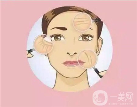 熱瑪吉拉皮除皺多少錢？