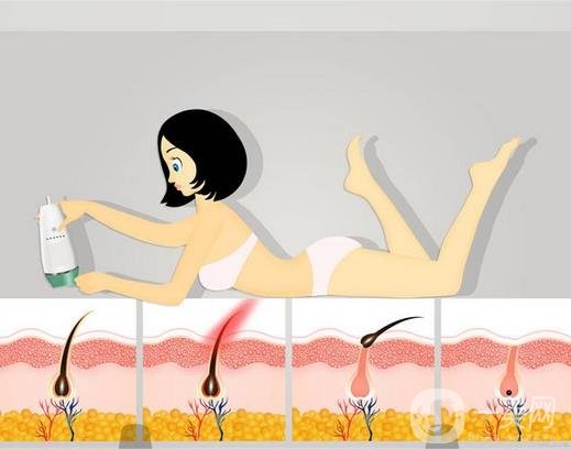 激光脫毛價(jià)格是多少 激光脫毛好不好