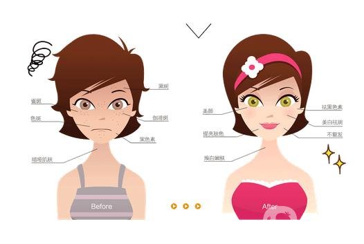 手術(shù)祛痣價格