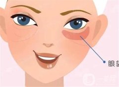 超聲波去除眼袋的優(yōu)勢有哪些？原理是什么