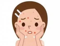 果酸祛痘的原理？果酸的祛痘果好不好？