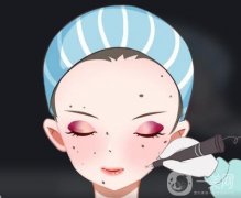 激光點(diǎn)痣后不能吃什么？可以吃辣椒嗎？