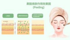 果酸換膚前后需要注意什么？這幾點(diǎn)一定要注意