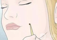 激光點(diǎn)痣后的凹洞如何護(hù)理？激光點(diǎn)痣后要忌口多久？