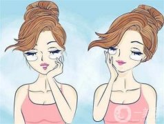 什么因素影響去除眼袋的價(jià)格？去眼袋的誤區(qū)有哪些？