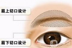 切眉吃韭菜的好處是什么？切眉手術(shù)有哪些注意事項(xiàng)？