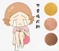 雞皮可以用激光去除嗎？具體有哪些注意事項(xiàng)呢？