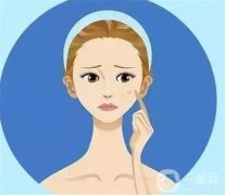 哪些因素影響激光祛斑的價(jià)格？多少錢一個(gè)療程？