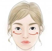 怎么緩解削骨瘦臉術(shù)后的疼痛？