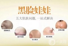 黑臉娃娃激光美容術(shù)前術(shù)后注意事項(xiàng)有哪些？