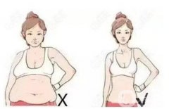 激光溶脂價格貴不貴？普通工薪族可以負擔的起嗎？