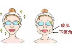 削骨手術多少錢？磨骨收費價格影響因素都有哪些呢？