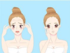 像素射頻除皺怎么樣？價格收費貴不貴？有后遺癥嗎