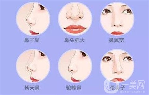 徐州二院整形美容科價(jià)格表，附隆鼻整形案例