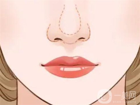 徐州二院整形美容科價(jià)格表，附隆鼻整形案例