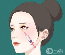 面部吸脂的原理是什么？過程是怎么樣的？