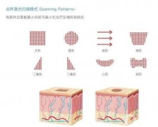 哪些情況可以做點陣激光？