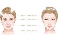 射頻緊膚有沒(méi)有果？適合什么人？