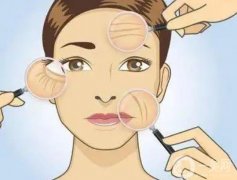 深藍(lán)射頻是什么果？術(shù)前準(zhǔn)備？