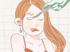 切眉后過多久可以紋眉？術(shù)后怎么護(hù)理？