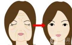 熱瑪吉緊膚價格貴不貴？有哪些因素會影響到價格？這些注意事項需知