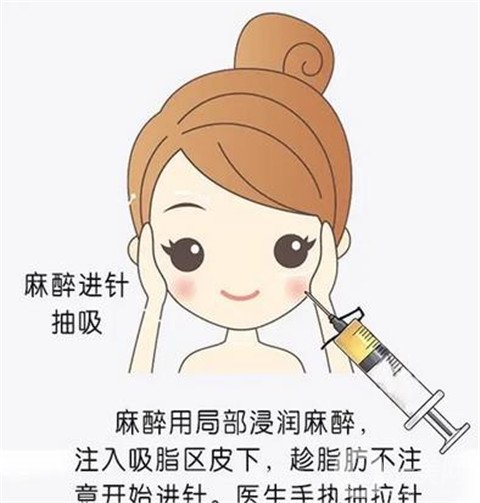 光纖溶脂價格,上海九院做光纖溶脂貴嗎