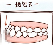 地包天調(diào)節(jié)方法有哪些？注意事項(xiàng)？