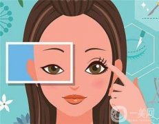 不同雙眼皮的手術(shù)流程？