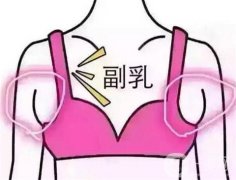 副乳切除術(shù)有害嗎？疼嗎？有果嗎